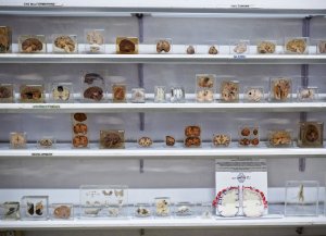 dissected specimens of brains